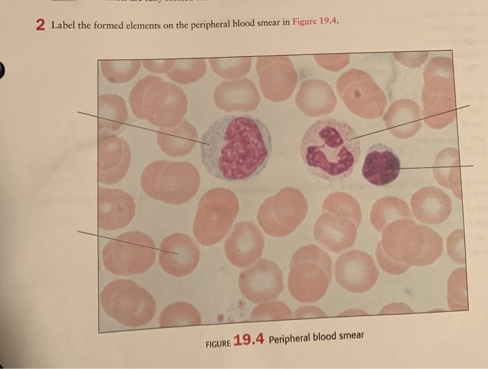 solved-2-label-the-formed-elements-on-the-peripheral-blood-chegg