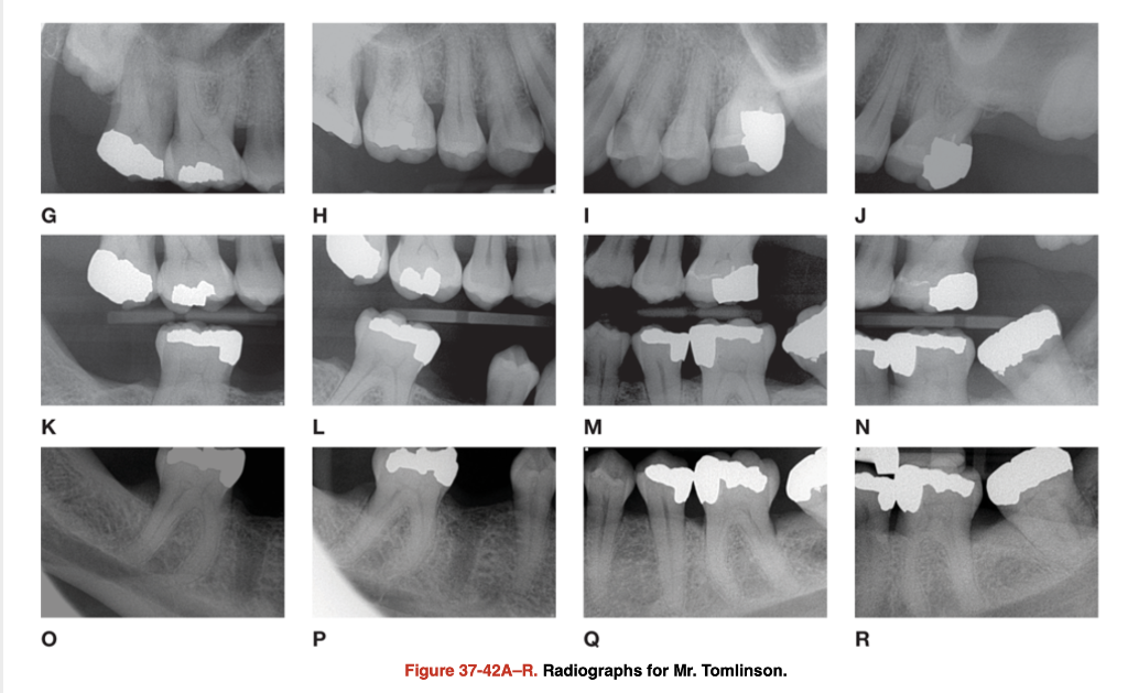 solved-what-etiologic-risk-factors-for-gingival-and-chegg