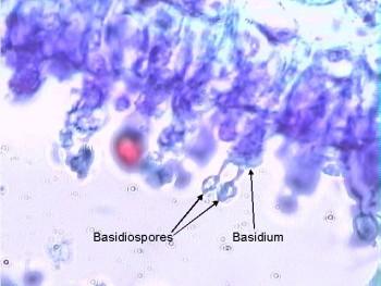 mushroom under microscope labeled