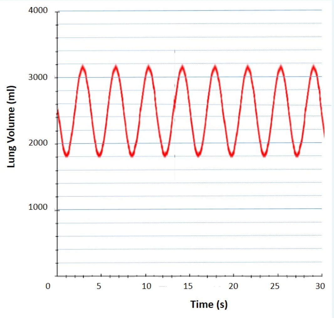 Solved From the spirometer tracing, calculate Breathing