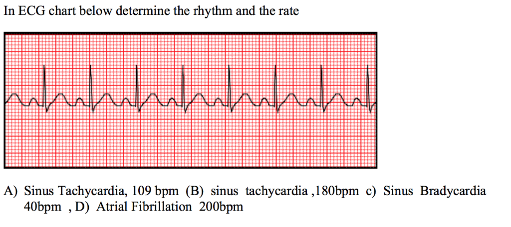 Solved 55. Identify the type AV block in the ECG below a) | Chegg.com