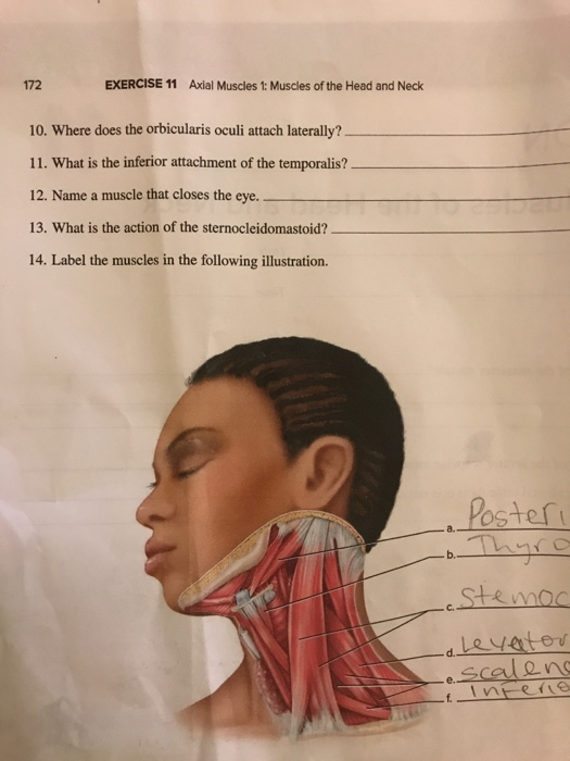 Solved 172 EXERCISE 11 Axial Muscles 1: Muscles of the Head | Chegg.com