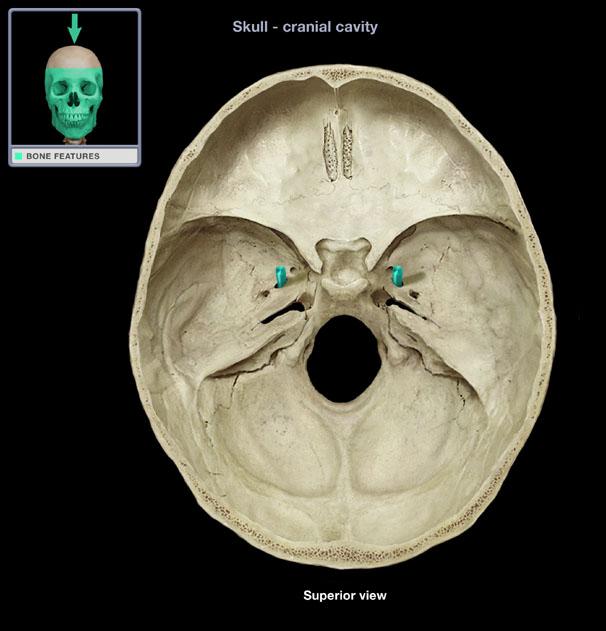 foramen rotundum xray