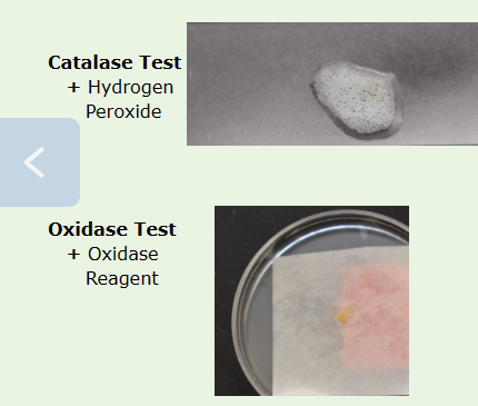 Solved Catalase Test Hydrogen Peroxide Oxidase Test Chegg Com   Php6g6jnJ