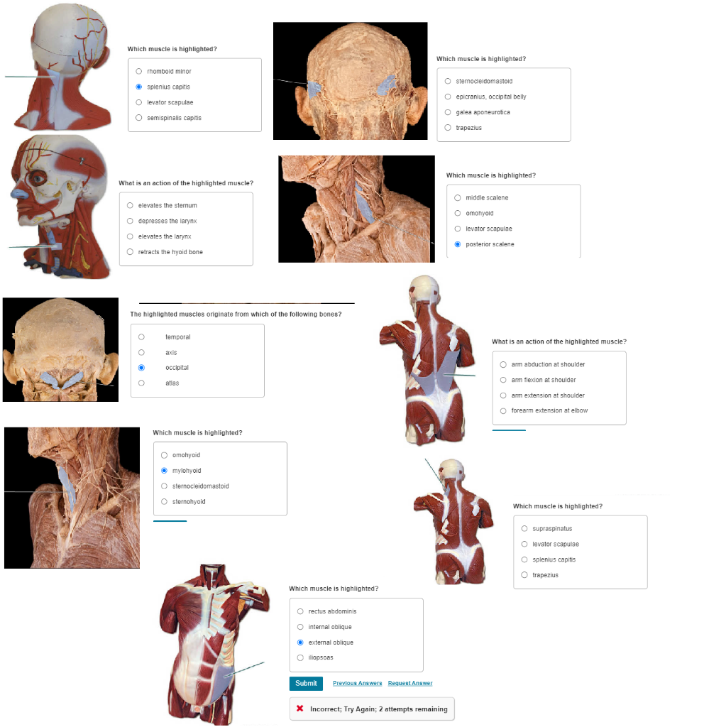 solved-which-muscle-is-highlighted-which-muscle-is-chegg