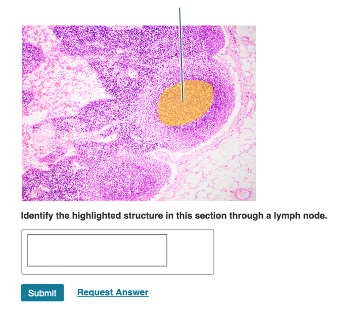 solved-identify-the-highlighted-structure-in-this-section-chegg