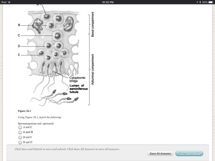 Solved Pad 10:32 PNM ?* 90%- ? ) Cytoplasmic bridge Lumen | Chegg.com