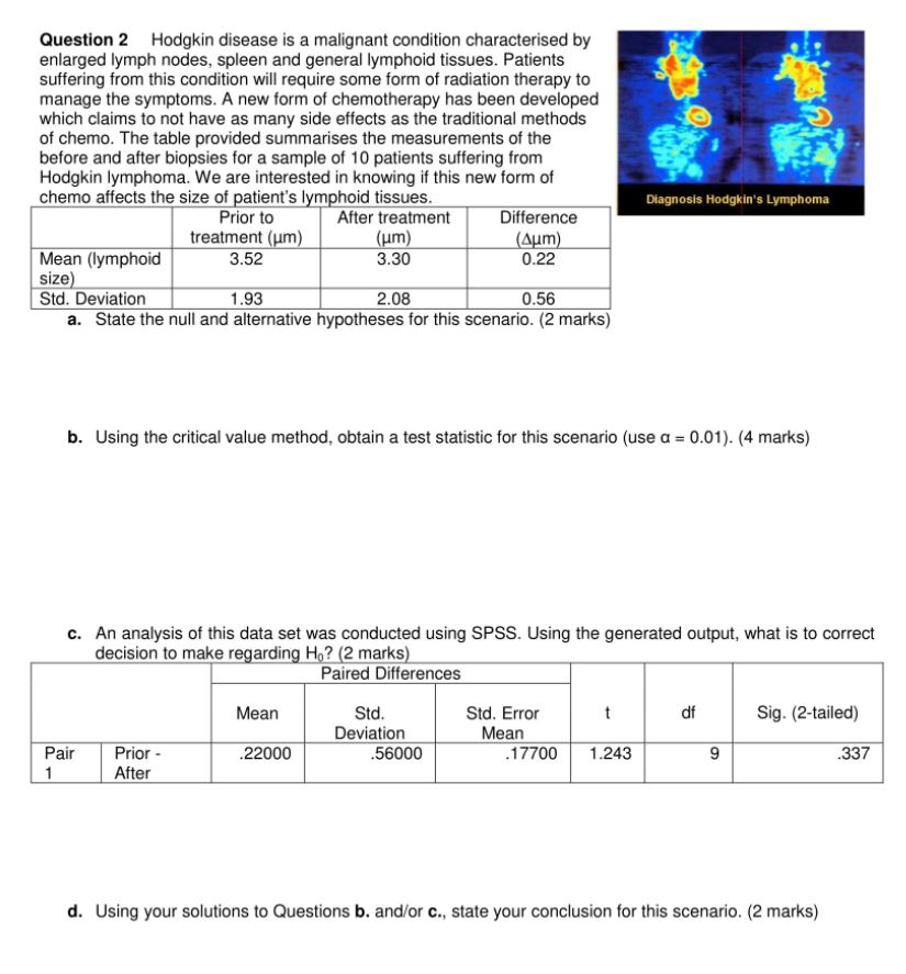 Radiation Therapy Questions And Answers All About Radiation