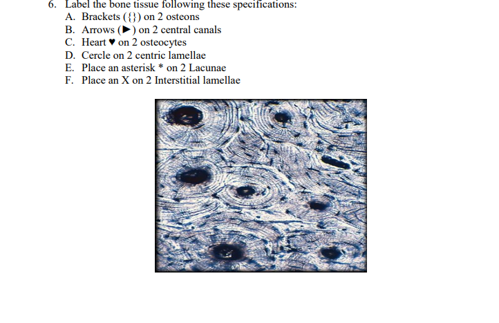 Solved 4. Label the different layers of the skin using the | Chegg.com