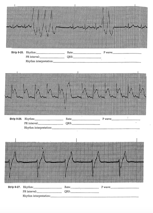 Strip 9-25. Rhythm_ PR interval Rhythm | Chegg.com