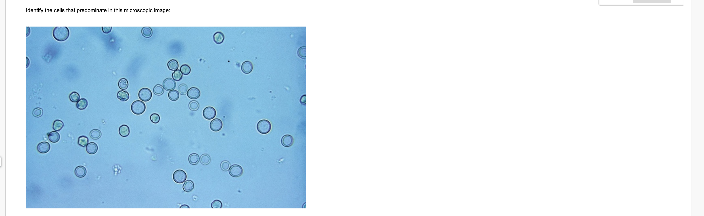 Solved Identify the predominant microscopic image | Chegg.com