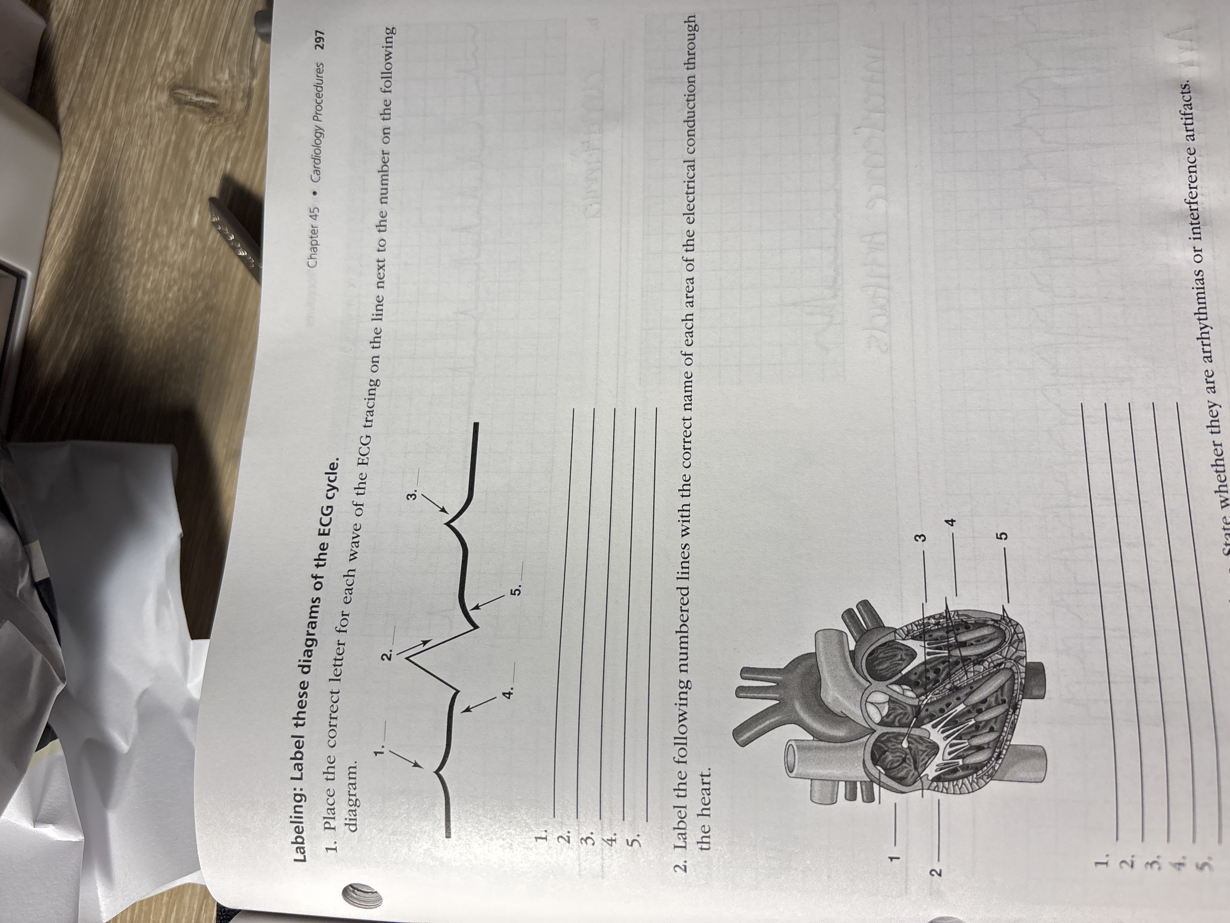 Solved Labeling: Label these diagrams of the ECG cycle.1. | Chegg.com