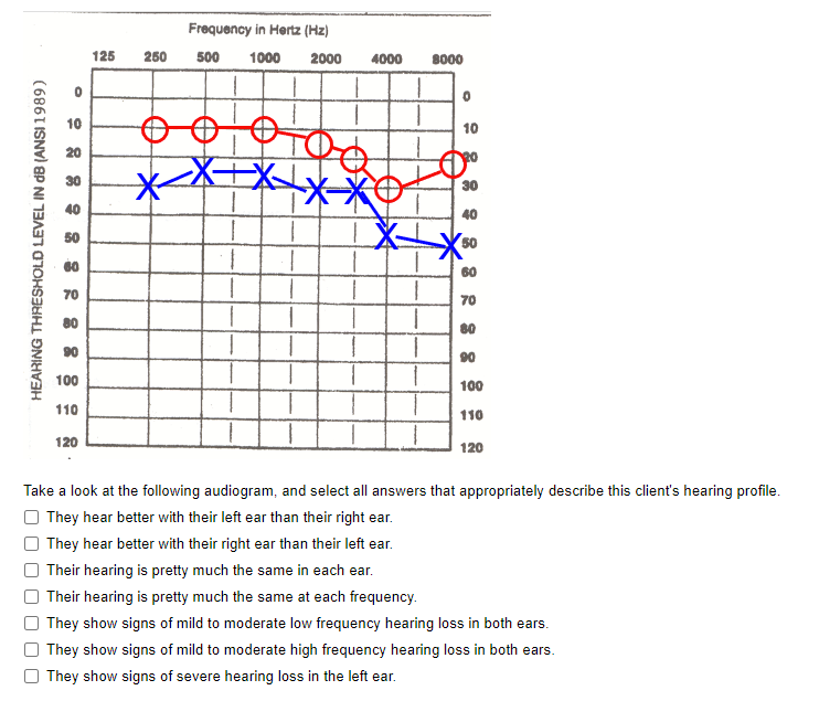 Solved Take a look at the following audiogram and select Chegg com