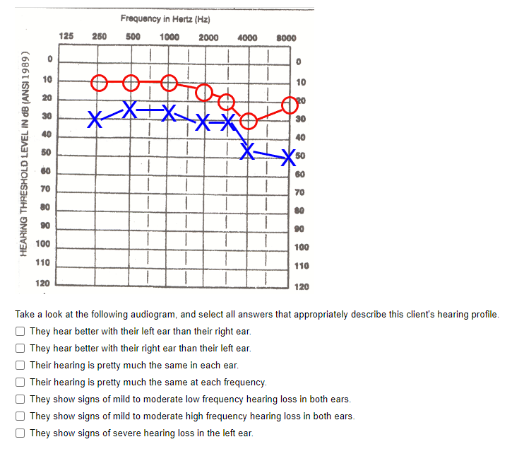 Solved Take A Look At The Following Audiogram, And Select | Chegg.com