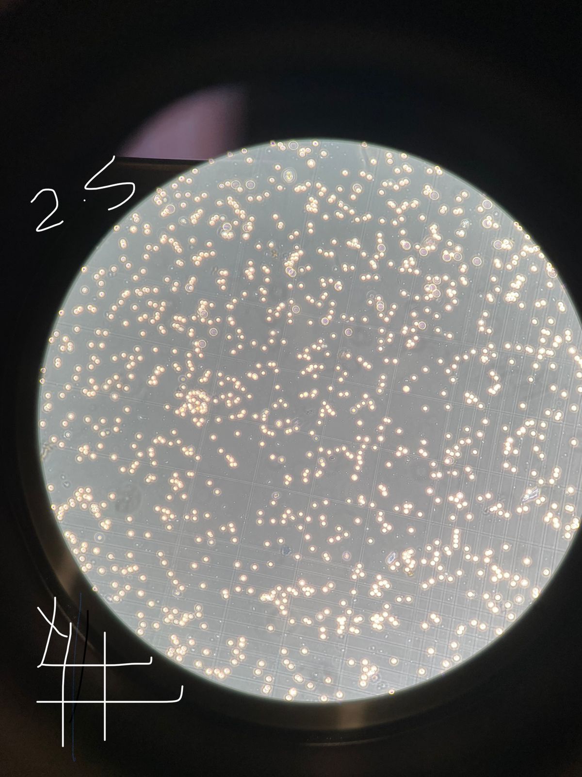 Solved Counting trypsinized cells (with 2.5% 0% (control) | Chegg.com