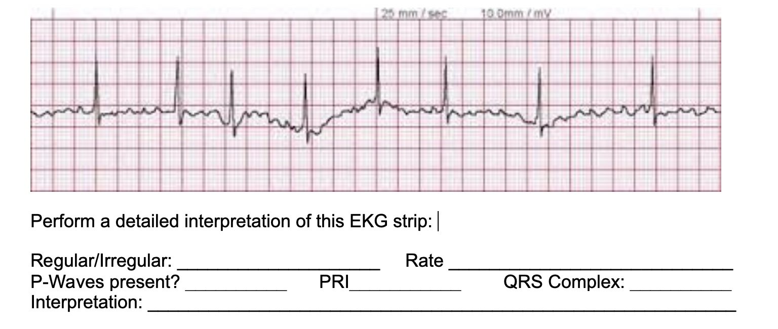 solved-interpretation-of-this-ekg-regular-or-chegg