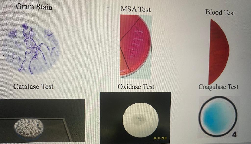 Solved - what is the unknown bacteria ? image below is | Chegg.com