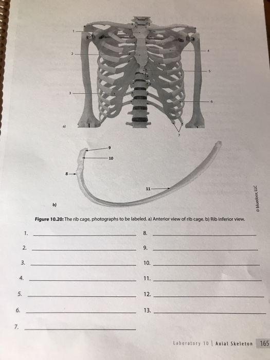 Solved 10 b) Figure 10.20 The rib cage, photographs to be