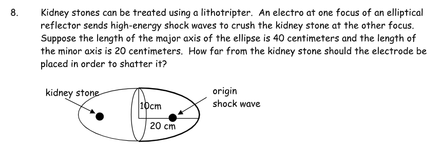 Solved 8. Kidney stones can be treated using a lithotripter. | Chegg.com