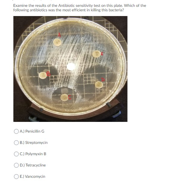 Solved Examine the results of the Antibiotic sensitivity | Chegg.com