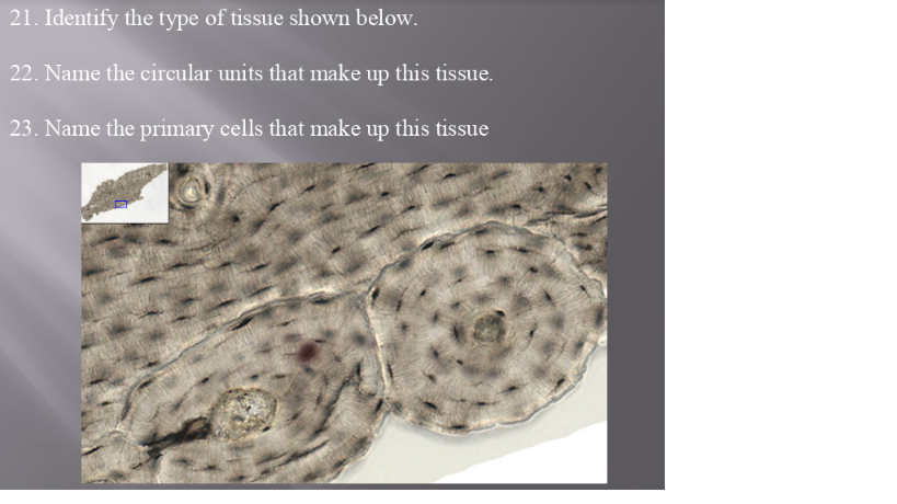 Solved 21. Identify the type of tissue shown below. 22. Name | Chegg.com