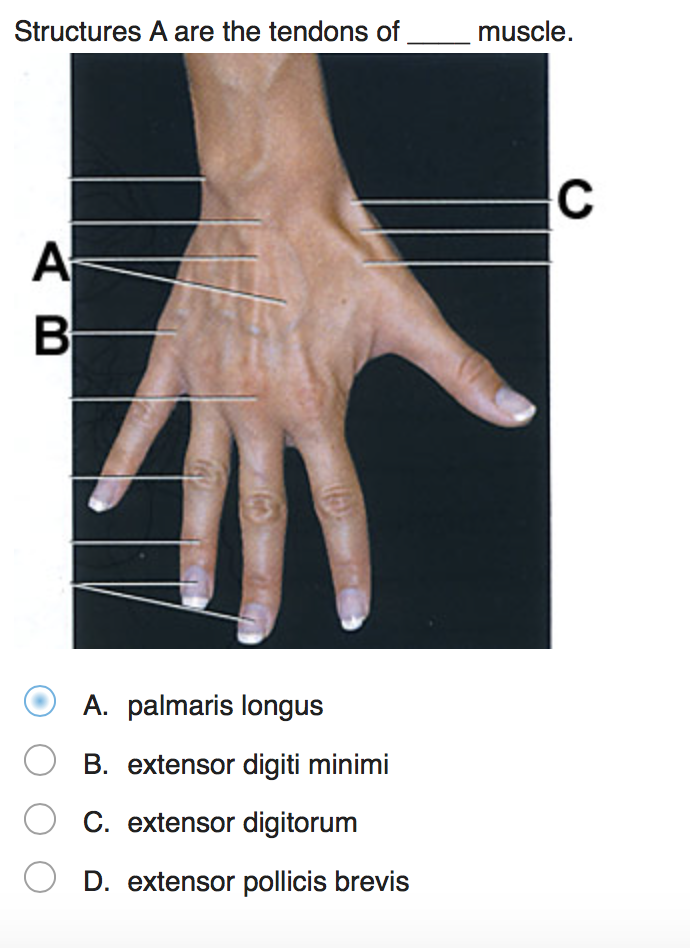 Solved Structures A are the tendons of muscle. C A B A. | Chegg.com