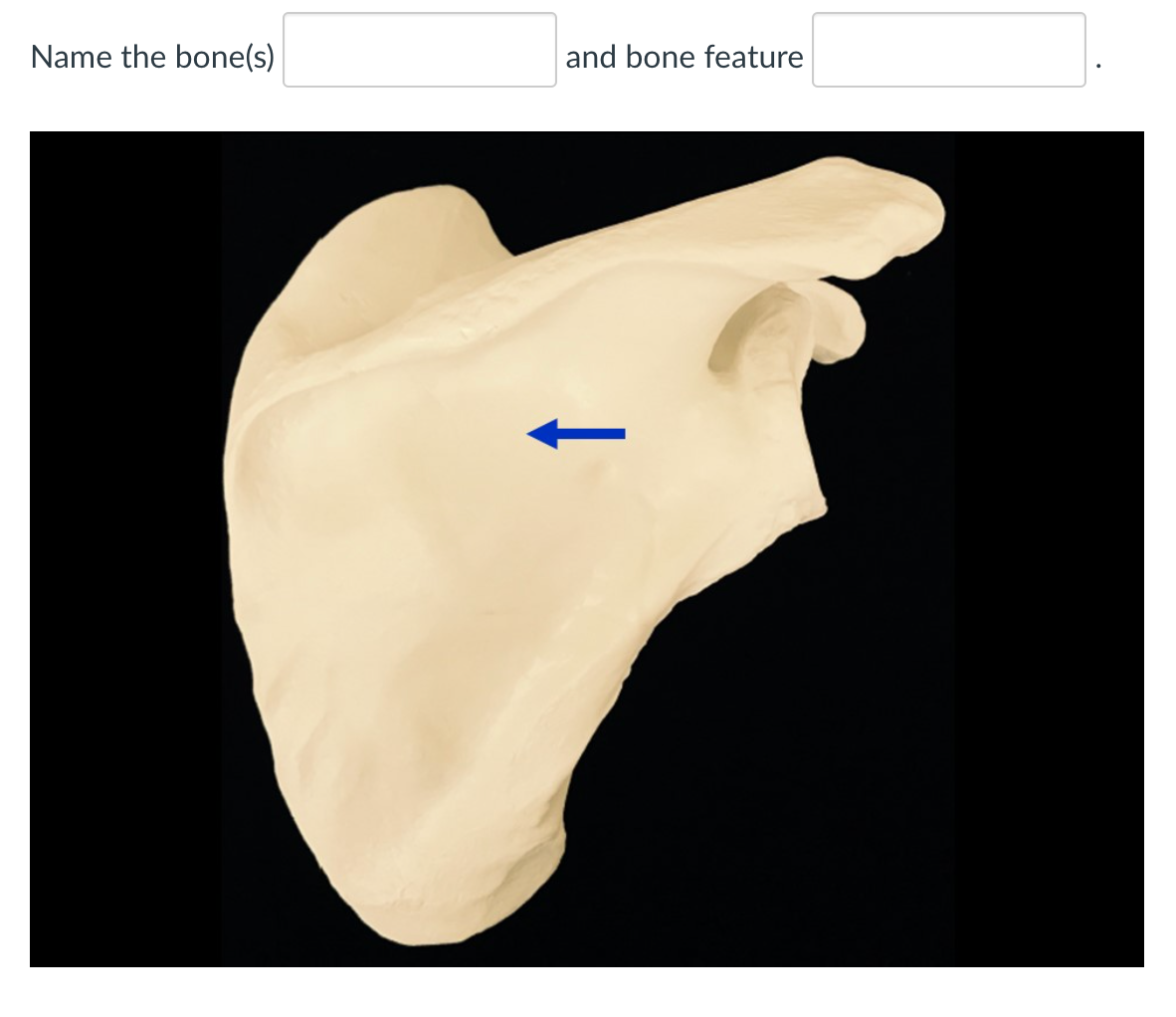 Solved Name the bone(s) and bone feature Name the bone(s) | Chegg.com