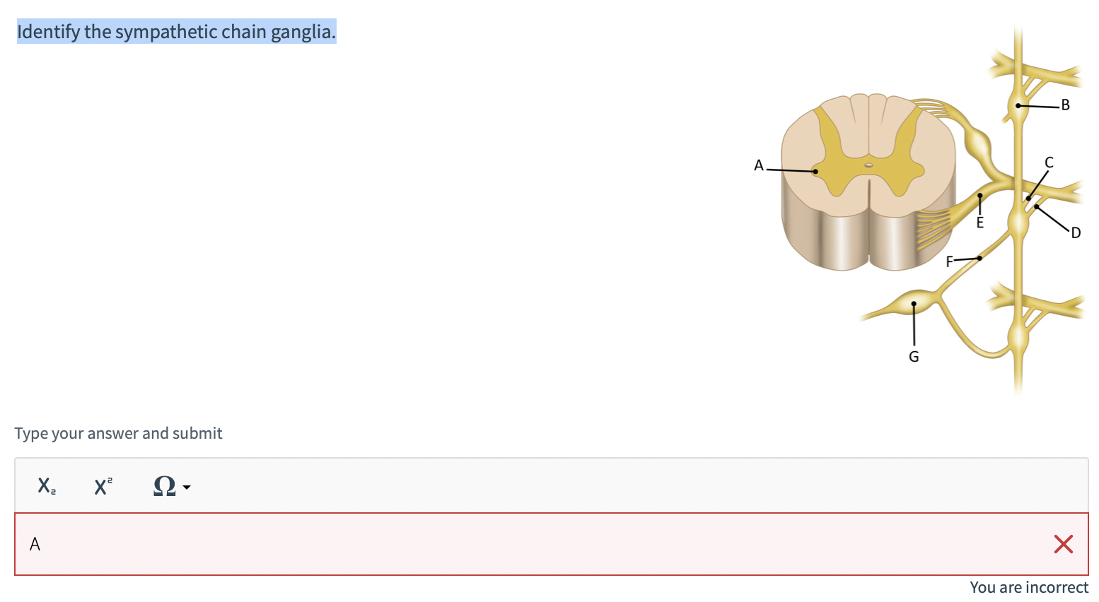 Solved Identify the sympathetic chain ganglia. Type your