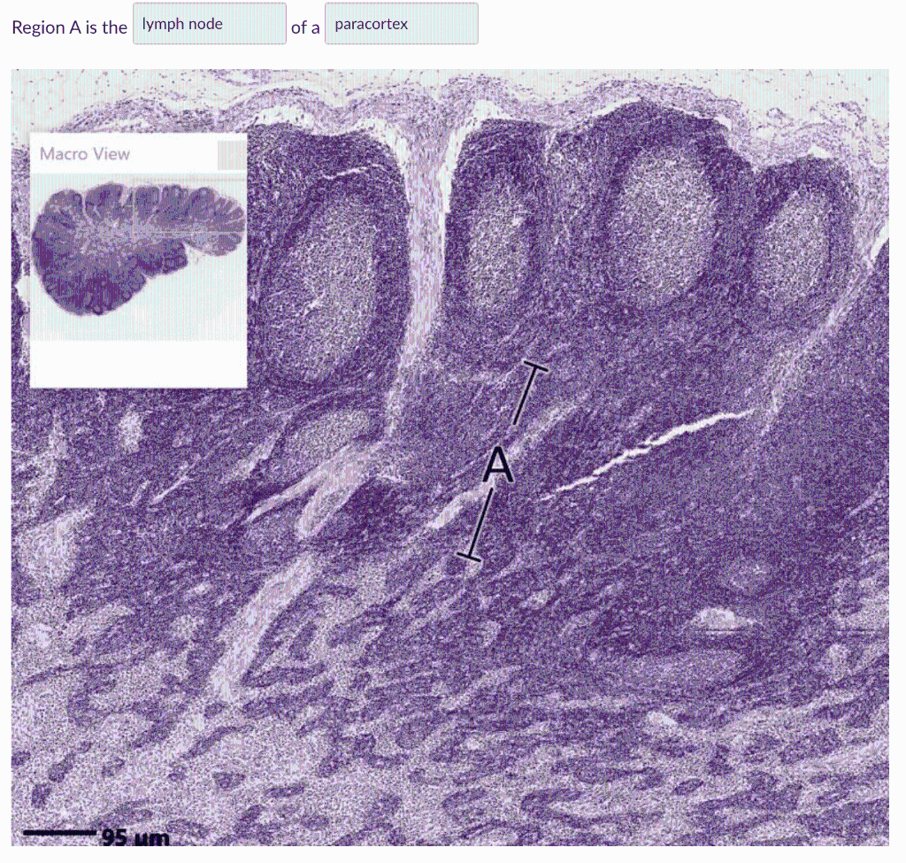 Solved Region A is the lymph node of a paracortex Macro View | Chegg.com