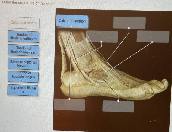 Solved 20 Correctly label the following anatomical parts of | Chegg.com