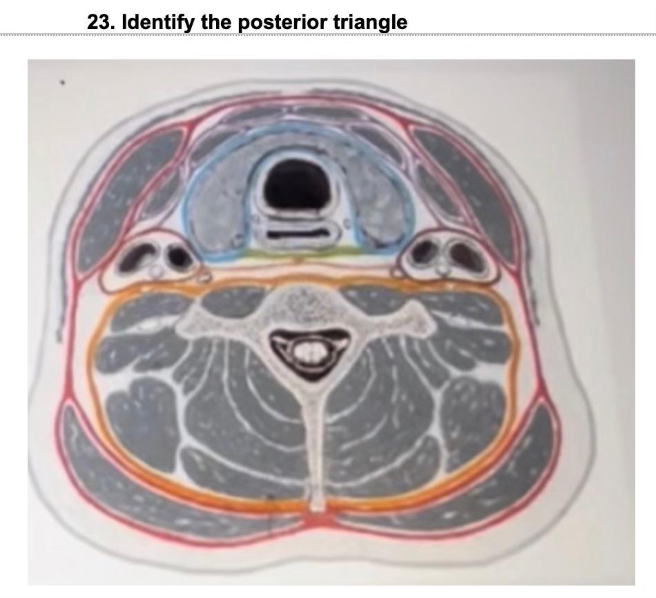 23. Identify the posterior triangle