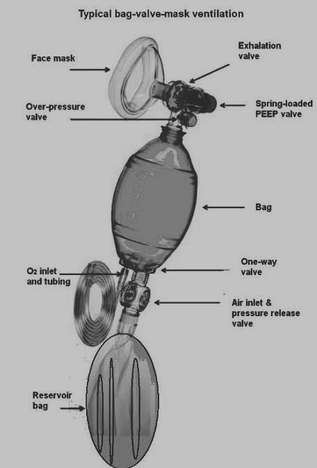 Bag valve mask ventilation - WikEM