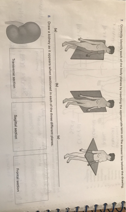 Solved 7 Correctly identify each of the body planes by | Chegg.com