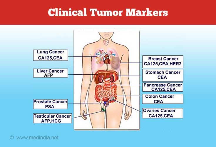 abdominal cancer markers ce înseamnă condiloame