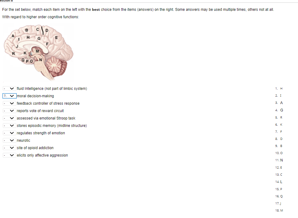 Solved For the set below, match each item on the left with | Chegg.com