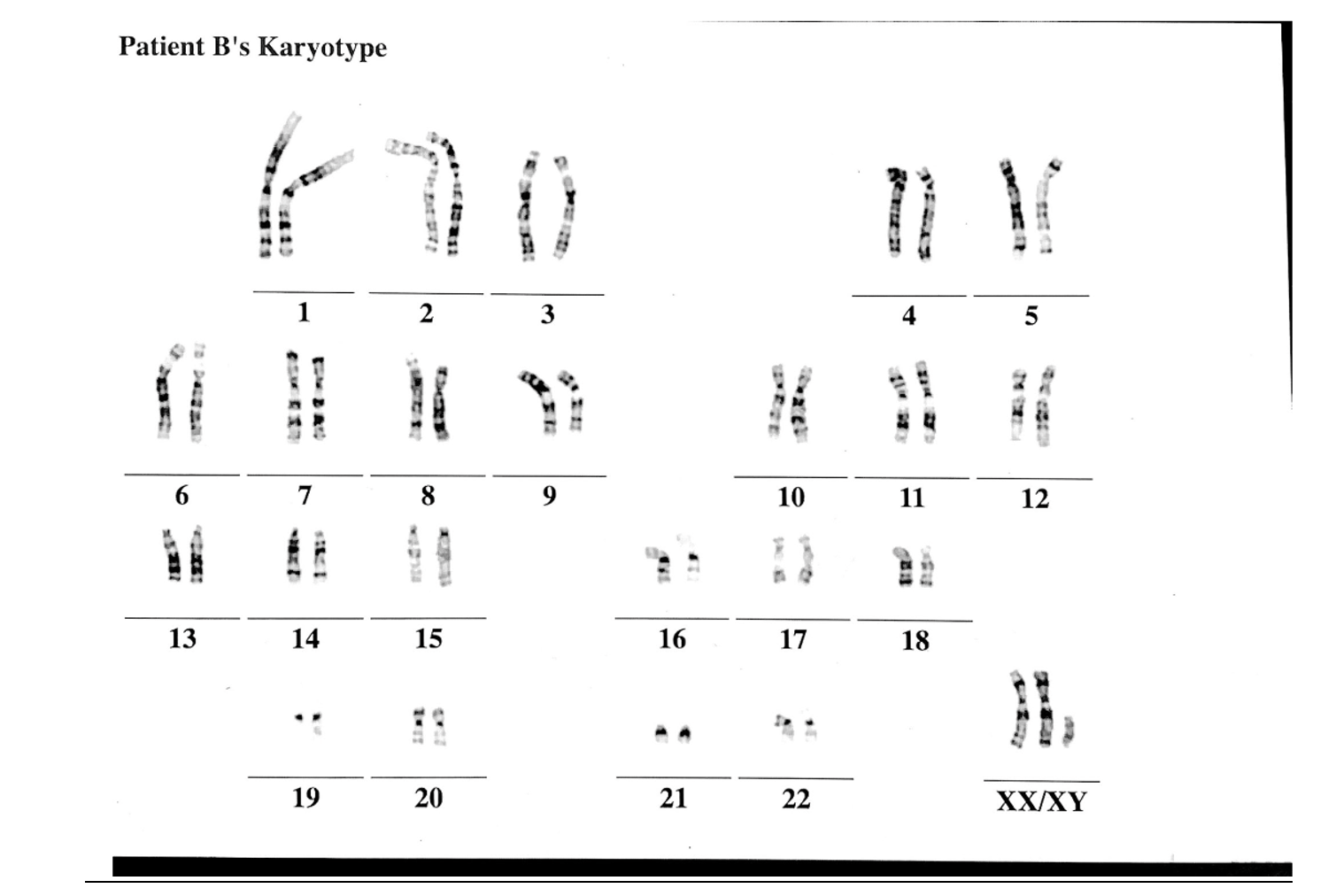 Solved Diagnosis of patients with abnormal chromosomes: | Chegg.com