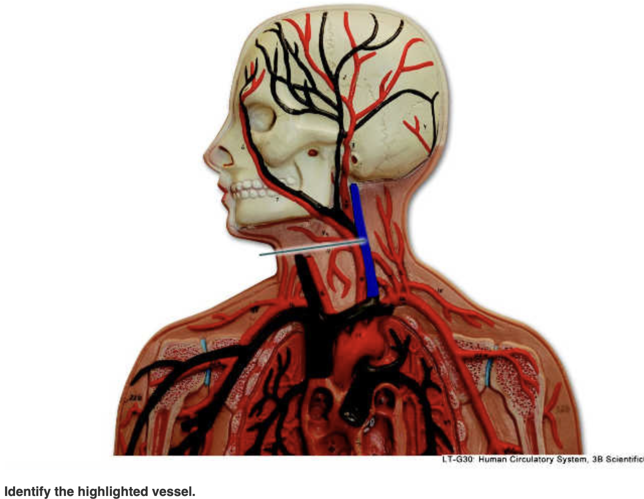 Solved Identify The Highlighted Vessel. | Chegg.com