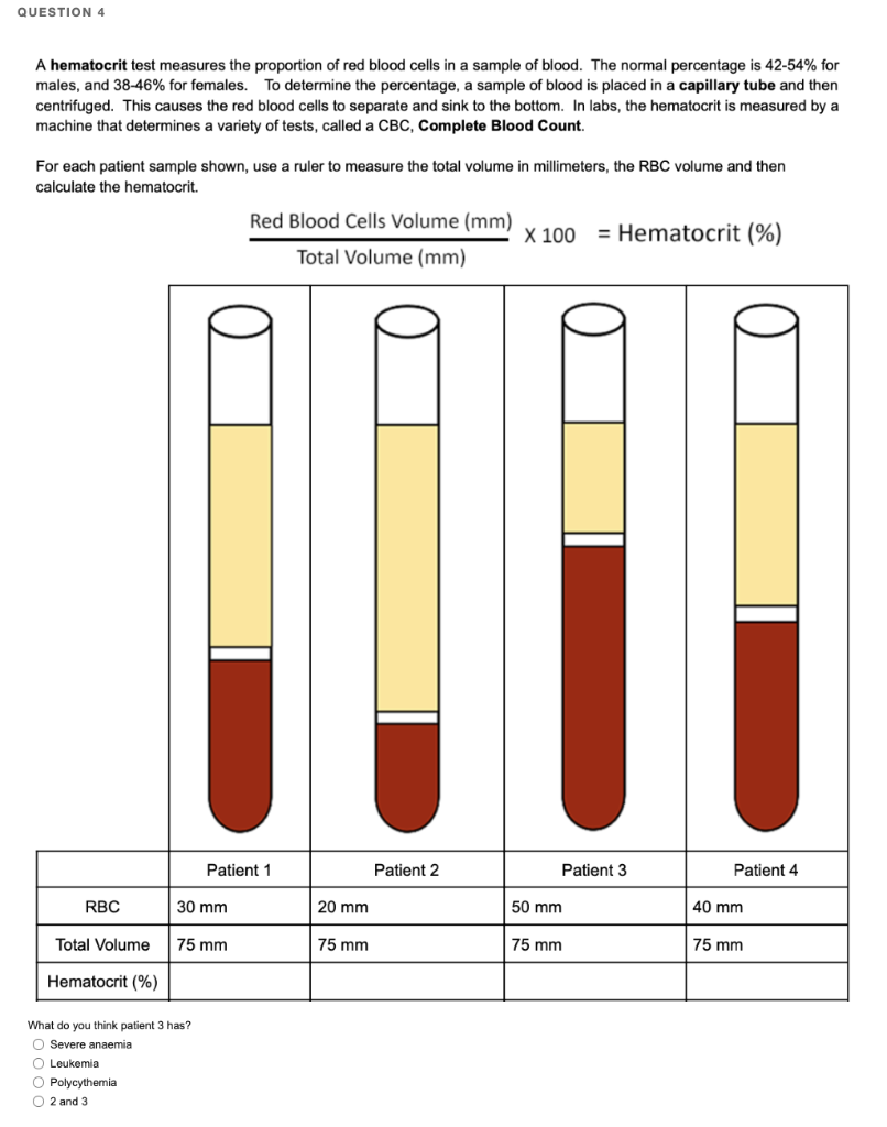 solved-a-hematocrit-test-measures-the-proportion-of-red-chegg