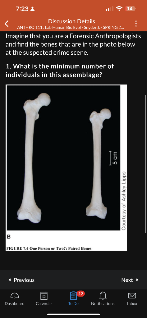 Imagine that you are a Forensic Anthropologists and | Chegg.com