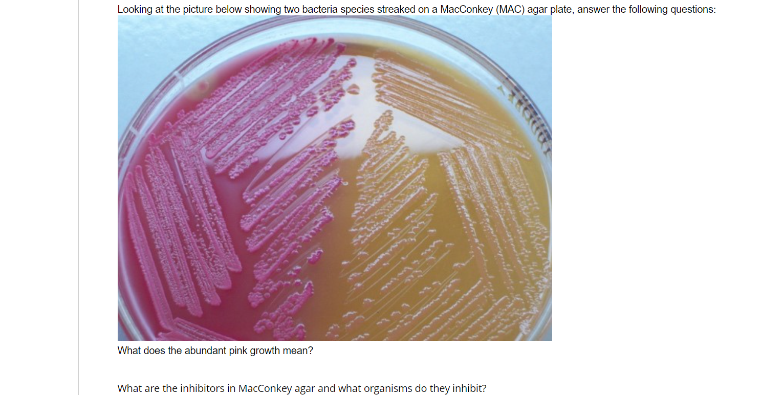 Solved Looking at the picture below showing two bacteria | Chegg.com