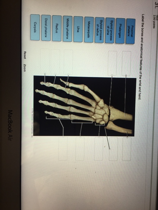 Solved Label the bones and anatomical features of the wrist | Chegg.com