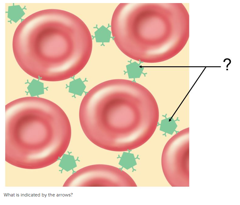 solved-what-is-indicated-by-the-arrows-chegg