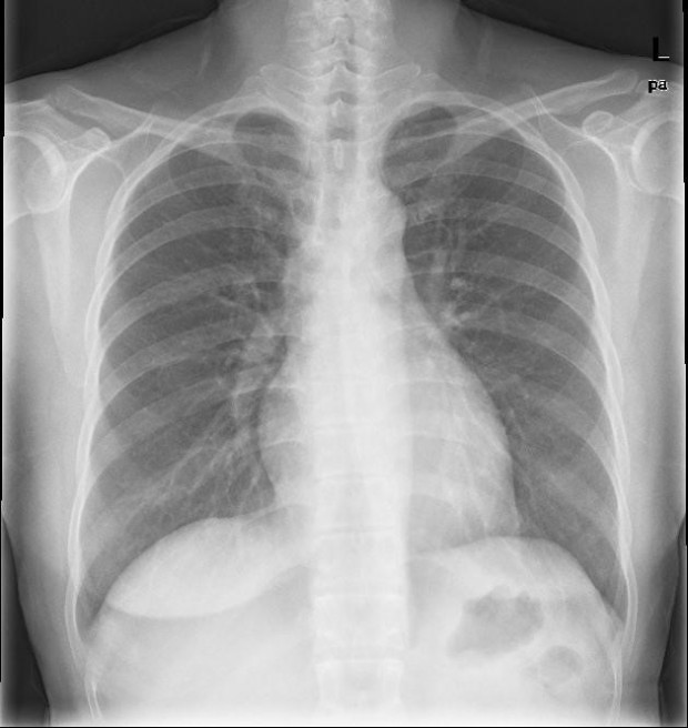 Solved Present a diagnostically acceptable PA chest image. | Chegg.com