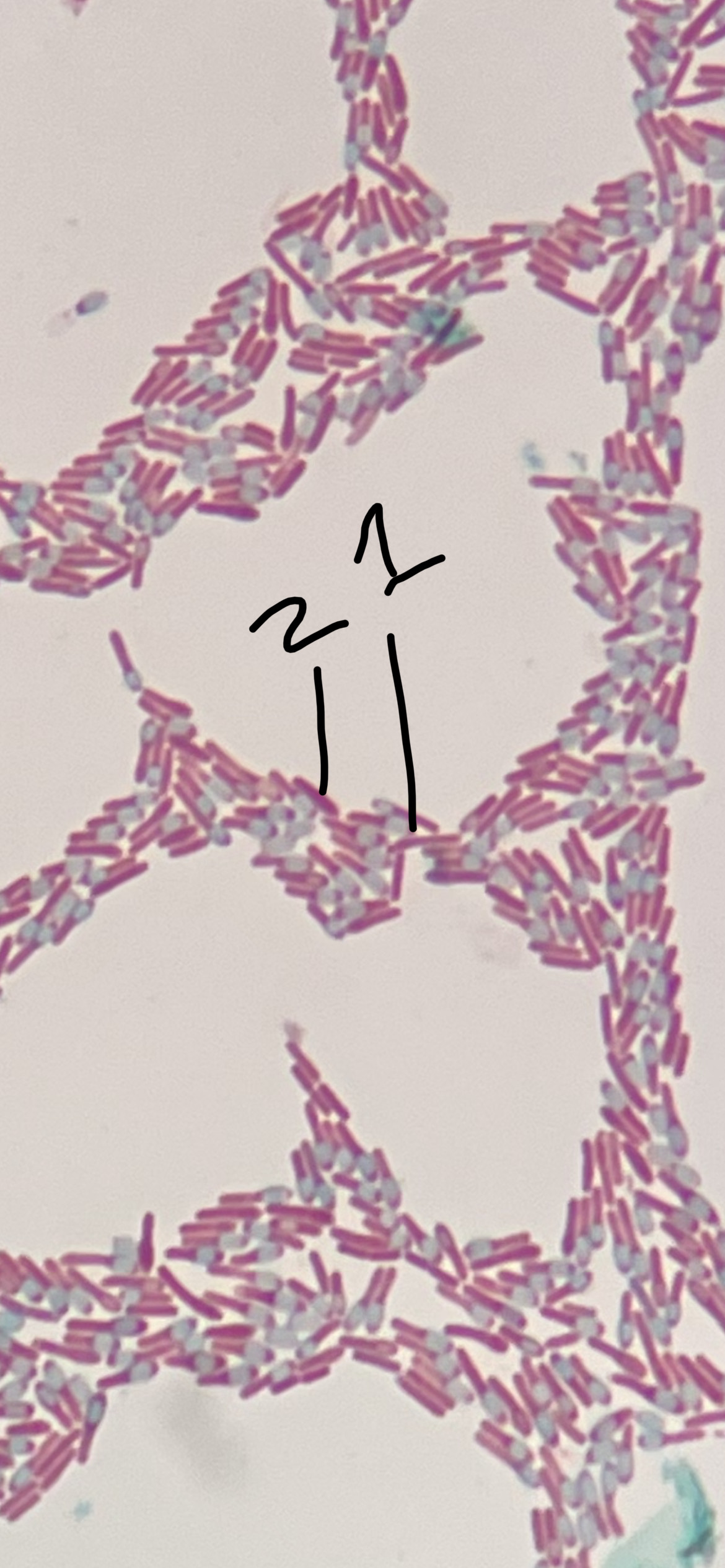 Solved Endospore stain of Clostridium pasteurianum shape and | Chegg.com