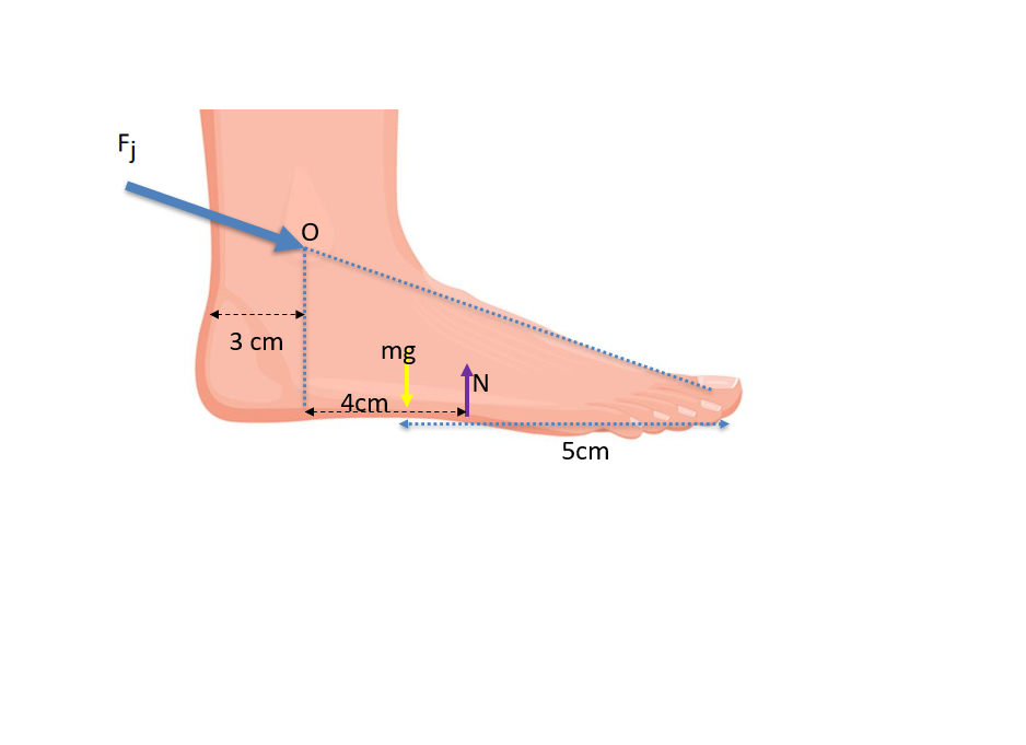 Solved In a static situation, a person is standing on one