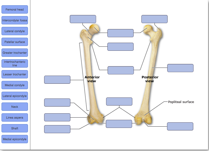 Solved Femoral head Intercondylar fossa Lateral condyle