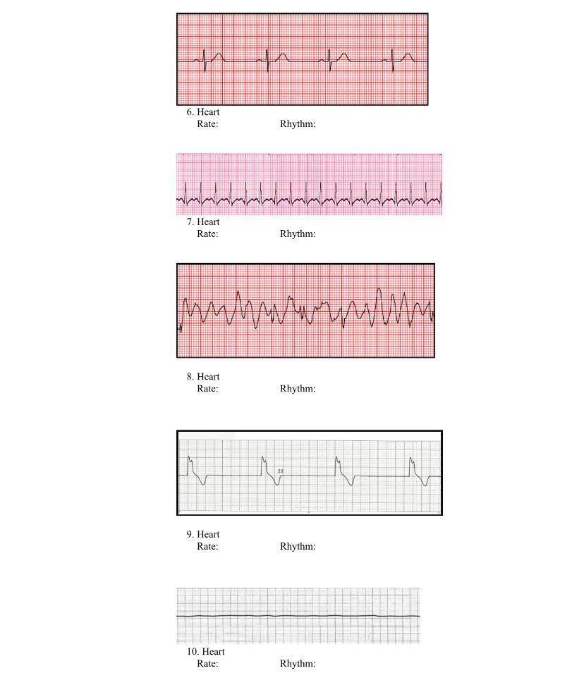 Ara ta 6. Heart Rate: Rhythm: 7. Heart Rate: Rhythm: има л/члили 8. Heart Rate: Rhythm: M 9. Heart Rate: Rhythm: 10. Heart Ra