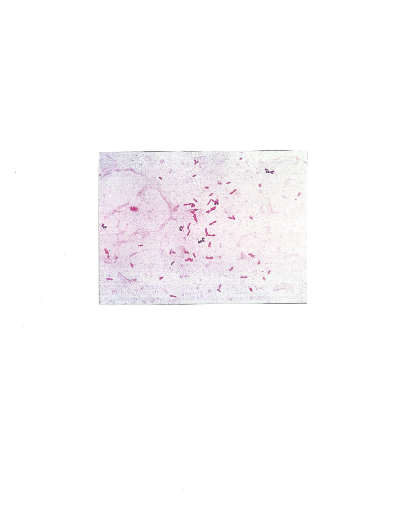 Solved Name The Gram Reaction (stain) And The Morphology Of | Chegg.com