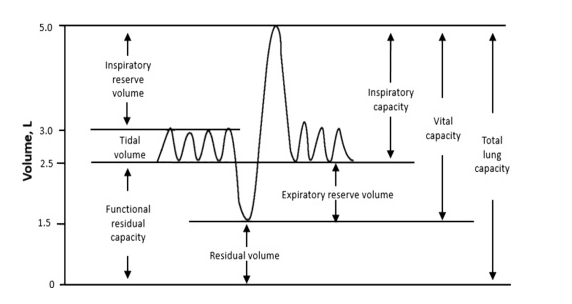 Solved A. Based on the spirogram, compute for the | Chegg.com