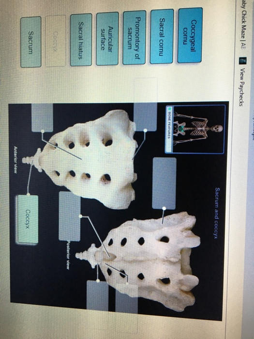 Solved Sacrum and coccyx al Sacral cornu Auricular surface | Chegg.com